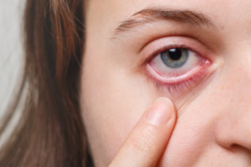 Jaké nemoci vám prozradí oči? Sledujte i barvu bělma