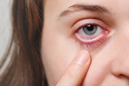 Jaké nemoci vám prozradí oči? Sledujte i barvu bělma
